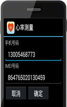 苹果手表关闭运营商方法？步骤是什么？