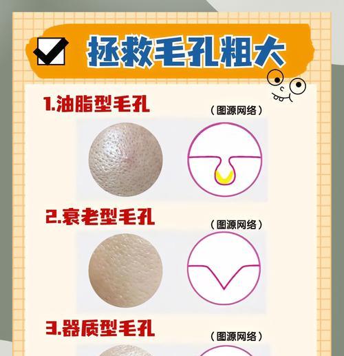 如何缩小脸上毛孔（有效的解决方法让你告别毛孔粗大）